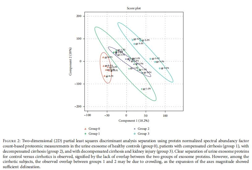Two-dimensional (2D) partial least squares discriminant analysis separation using protein normalized spectral abundancy factor count-based proteomic measurements in the urine exosome of healthy controls (group 0), patients with compensated cirrhosis (group 1), with decompensated cirrhosis (group 2), and with decompensated cirrhosis and kidney injury (group 3). Clear separation of urine exosome proteins for control versus cirrhotics is observed, signified by the lack of overlap between the two groups of exosome proteins. However, among the cirrhotic subjects, the observed overlap between groups 1 and 2 may be due to crowding, as the expansion of the axes magnitude showed sufficient delineation.